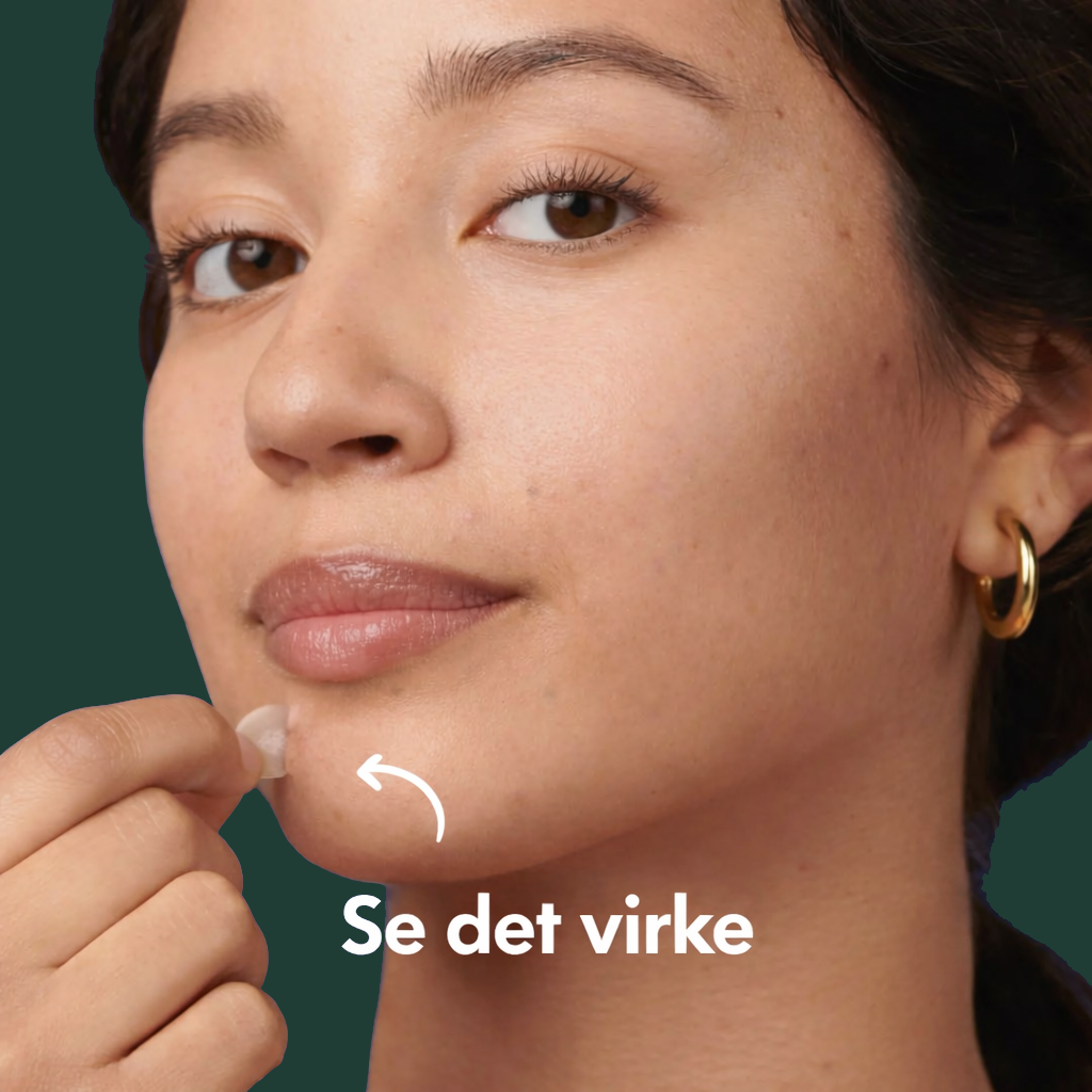 Hero Cosmetics Mighty Patch hydrocolloïd acnepleisters