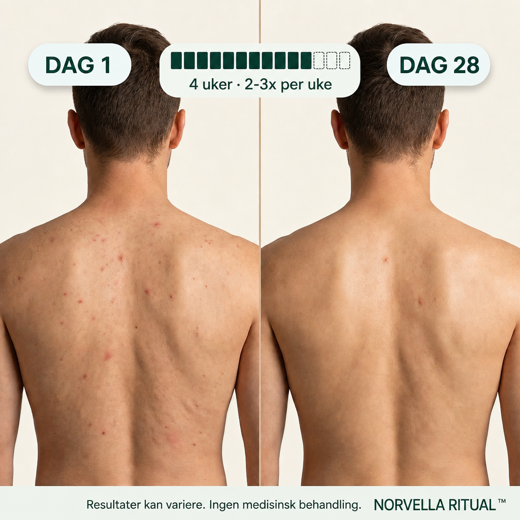 Norvella Hammam peeling dusjhåndkle