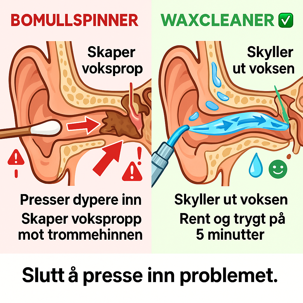 Bomullspinner vs WaxCleaner sammenligning