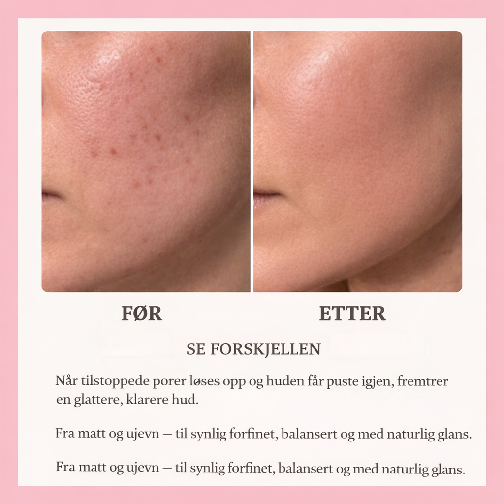 Cleanskin se forskjellen norsk