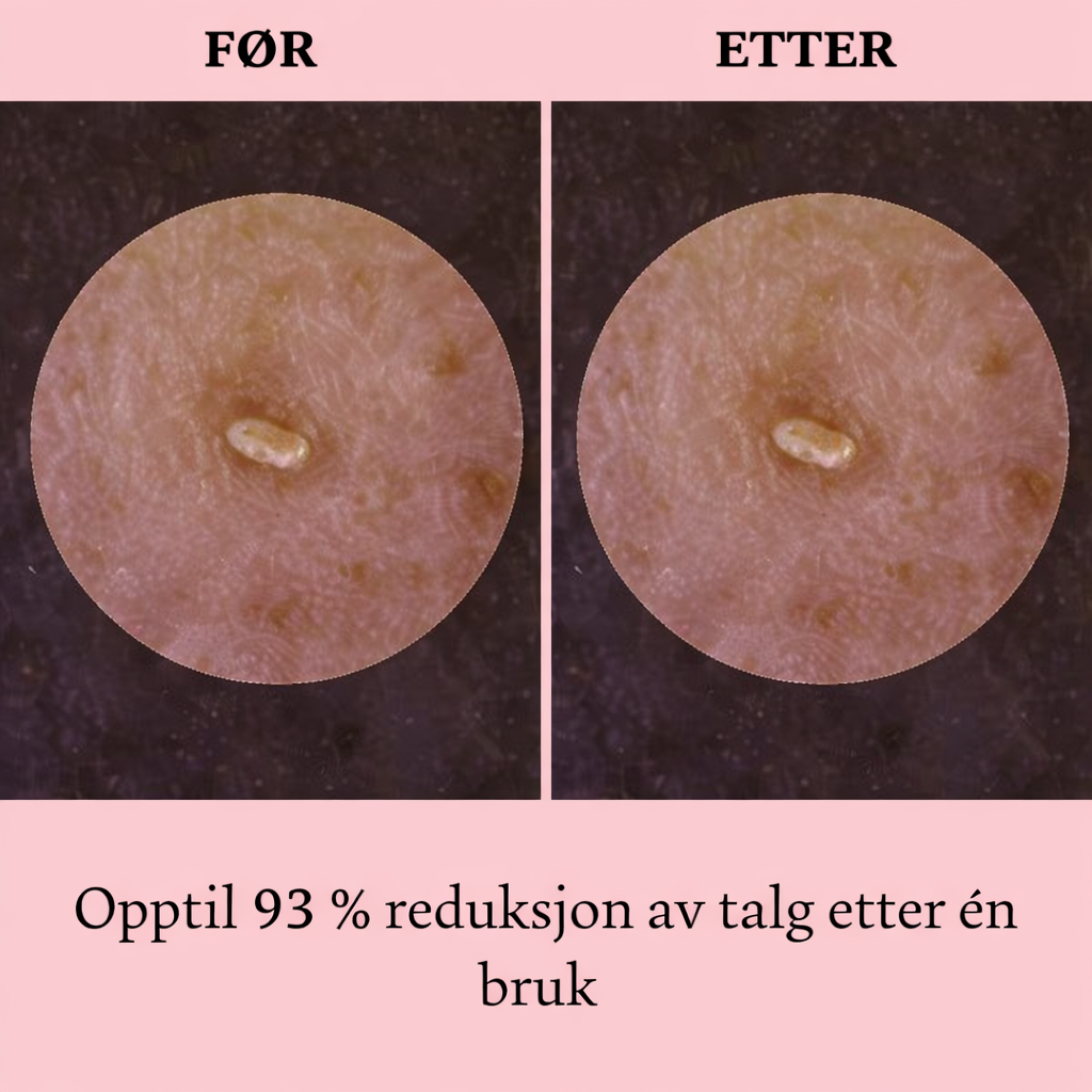 Cleanskin talg reduksjon norsk